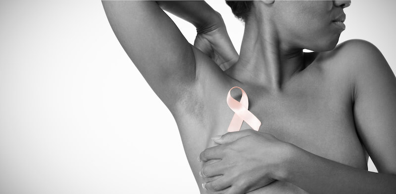 Hair Relaxer Breast Cancer Lawsuit